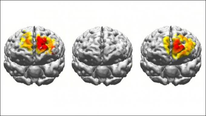 https://tomorrowsci.com/wp-content/uploads/2019/04/electrostimulation-brain-comparison-678x381.jpg